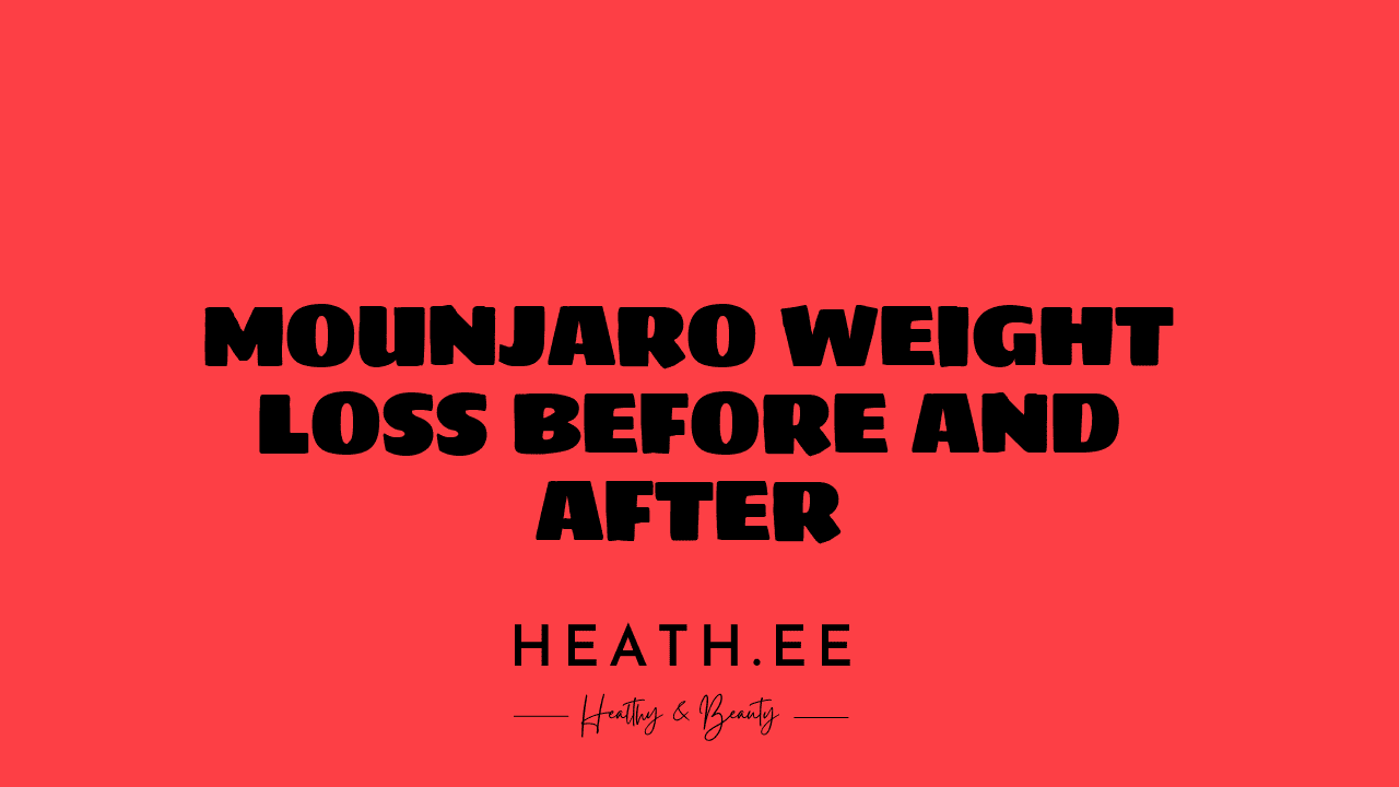 Mounjaro Before And After Pictures